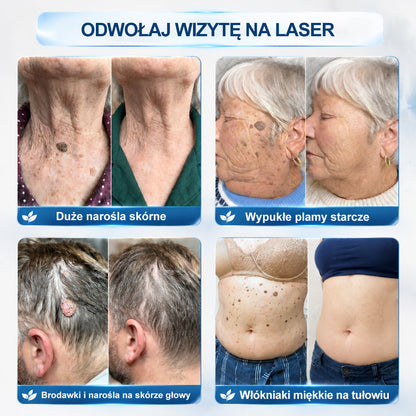 ⏰ Gratulacje! Ekskluzywna oferta na Hiskin® właśnie ruszyła! Zyskaj dodatkowe 50% zniżki – tylko dzisiaj! Zamów przez link już teraz! ⏰